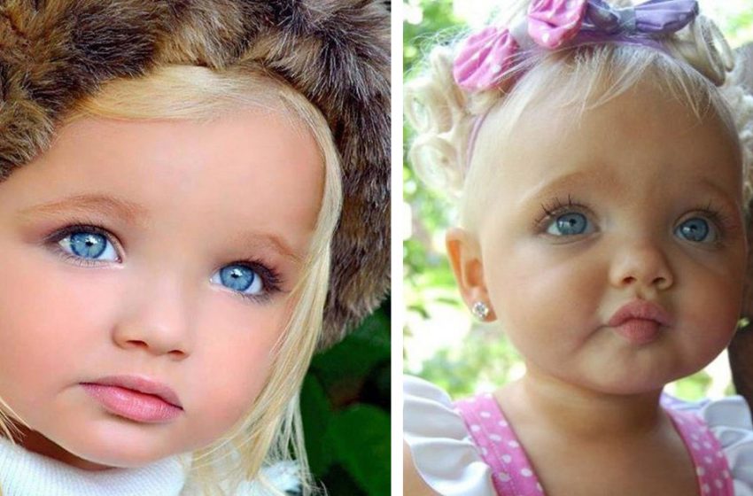  Wie sieht jetzt das Mädchen aus, das wegen seines ungewöhnlichen Aussehens den Spitznamen Puppe erhielt?