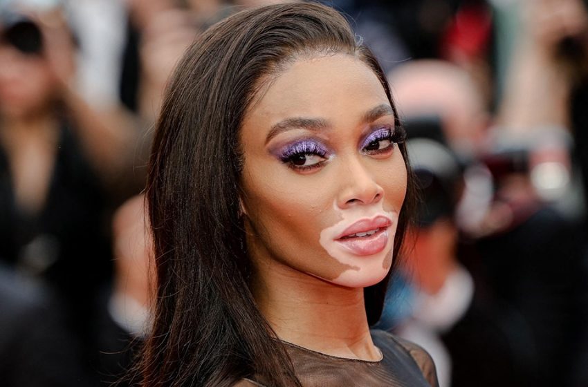  „Ehrlich und unanständig “: Supermodel Winnie Harlow kam in einem Kleid, das nichts bedeckte, zur Hochzeit einer Freundin