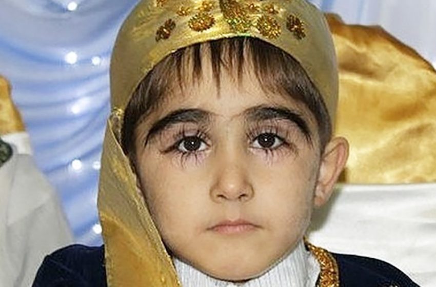  Wie sieht der Junge mit den längsten Wimpern der Welt heute aus?