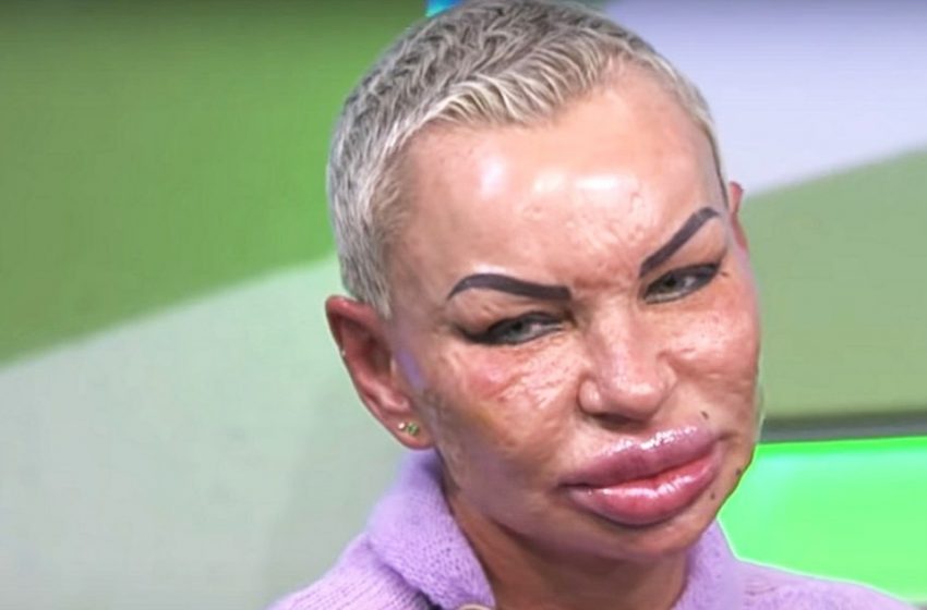  “Ich möchte mein altes Aussehen zurückbekommen!” Wie sieht Madame Michelle heute aus?