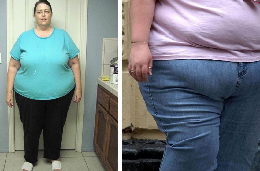  „Ich bin müde, so zu sein.“ Mit 63 Jahren verliert eine Frau 180 kg und überrascht ihre Verwandten