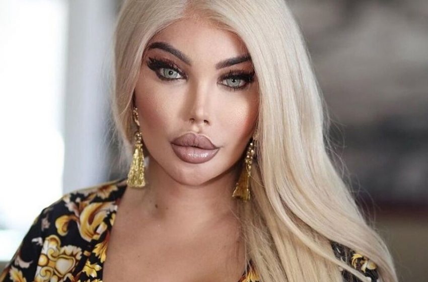  Das Model, das 74 plastische Operationen durchgeführt hat, hat das Ergebnis auf einem Urlaubsfoto gezeigt