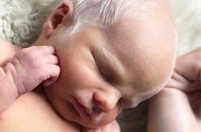  Ihr Baby wurde wegen seiner weißen Haare verspottet : Wie sieht es jetzt aus