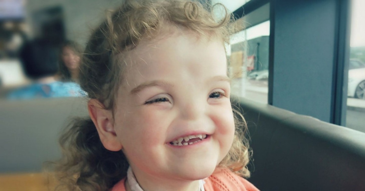 Die Geburt eines Mädchens ohne Nase hat die ganze Welt schockiert: Aber ...