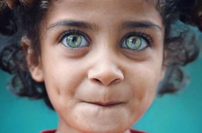  “Augen, die heller strahlen als alle Diamanten der Welt”: 17 Fotos von Kindern mit wunders