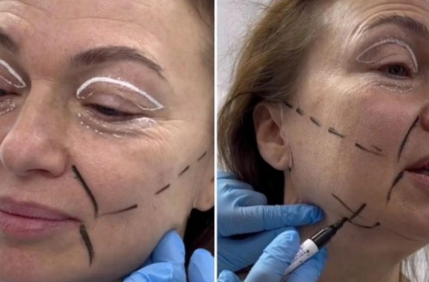  “Eine 58-jährige Frau hat alle mit den Ergebnissen ihrer Facelift-Operation überrascht”: Sie sollte sogar erwägen, ihren Pass zu aktualisieren!