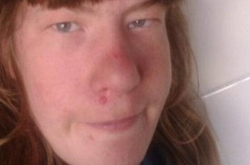  Ihre Erscheinung wurde sowohl in der Schule als auch online verspottet: Sieh dir an, wie die erwachsene Frau heute aussieht.