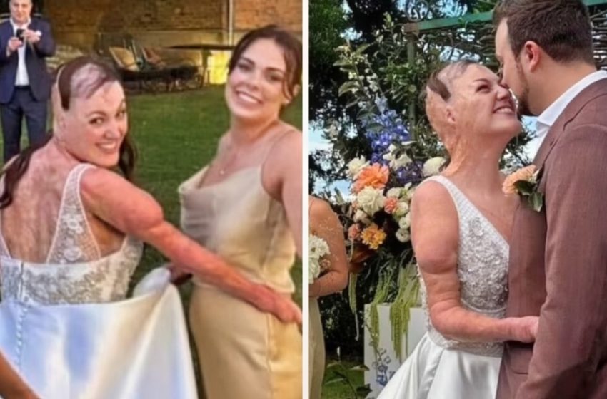  Der Hochzeitstag-Glanz einer Überlebenden und ihre Schwangerschaftstransformation: Wie sie während der Schwangerschaft aussieht!