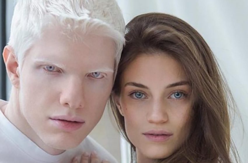 „Wie ein kleiner Engel“: So sieht der Sohn des Models und der schönsten Albino-Frau der Welt aus