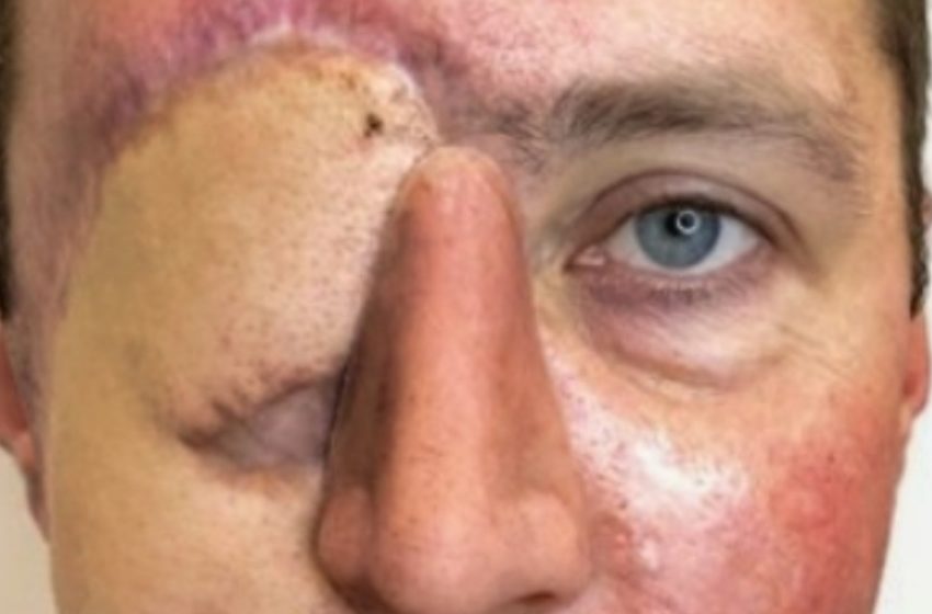  Nachdem er bei einem Autounfall ein Auge verlor, ließ dieser Mann einen Tätowierer sein Gesicht neu gestalten!: Die Ergebnisse sind einfach unglaublich!