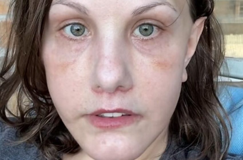  „Unkenntlich nach einem Facelifting für 15.000 \$“: Die Verwandlung des Mädchens bringt das Internet zum Ausrasten!