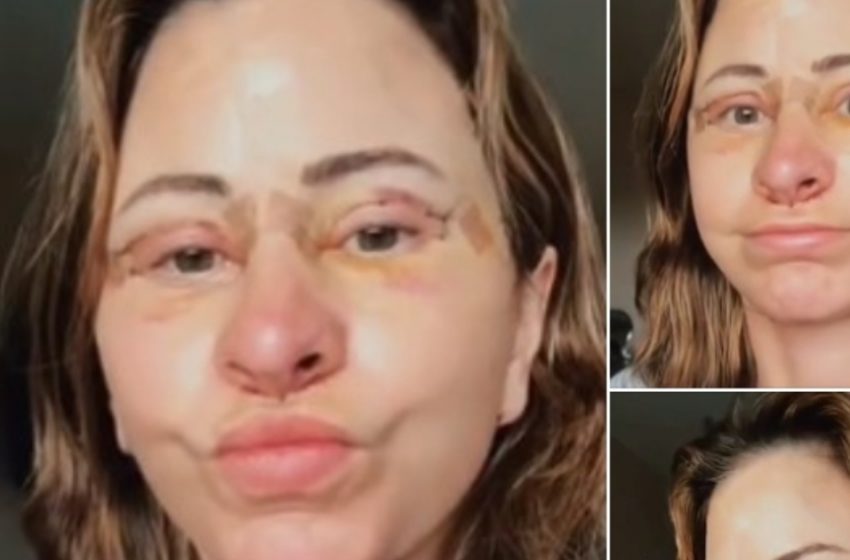 Frau gibt 14.000 Dollar für Facelift aus, verkauft ihr Haus und lebt jetzt im Van – alles nach einer atemberaubenden Verwandlung!