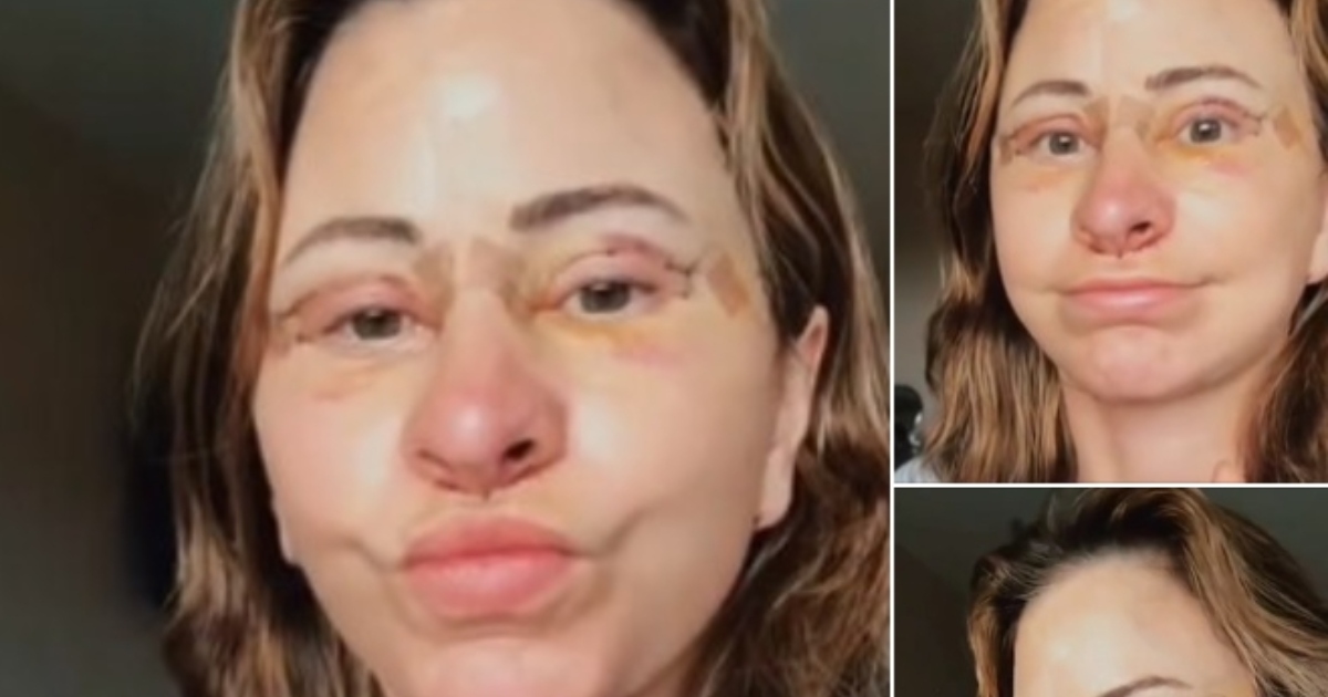 Frau gibt 14.000 Dollar für Facelift aus, verkauft ihr Haus und lebt jetzt im Van – alles nach einer atemberaubenden Verwandlung!