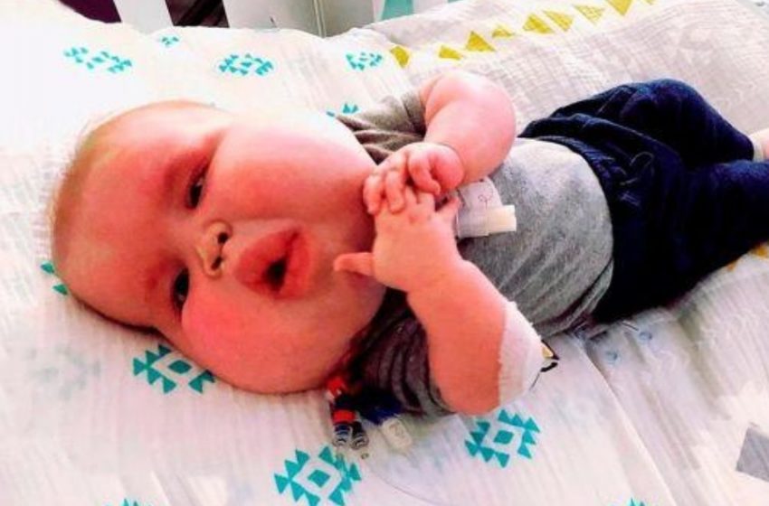  So sieht dieser kleine Junge, der mit einem ungewöhnlich großen Gesicht geboren wurde, heute aus!: Sieh dir die Fotos an!