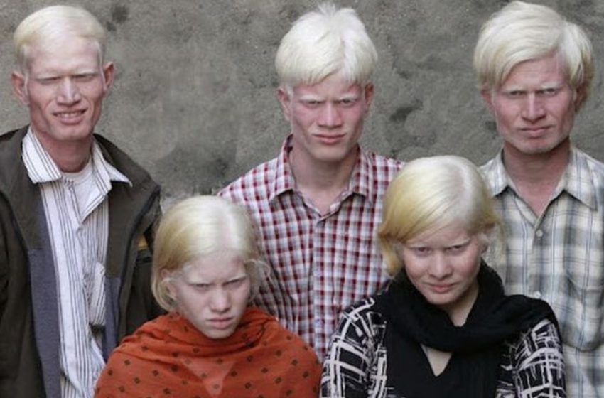  Die weltweit größte albino Familie zieht alle Blicke auf sich!: Mehr Fotos ansehen!