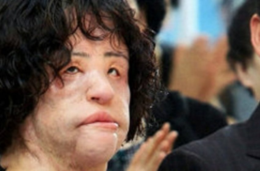  Hang Miokus überraschende Verwandlung: Die Schönheitsmission wird zum Albtraum!