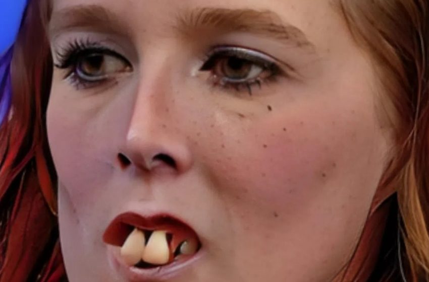  Berühmt für ihr einzigartiges Aussehen: Du wirst nicht glauben, wie sie jetzt nach der Zahnoperation aussieht!